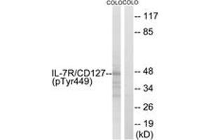 Western blot analysis of extracts from COLO205 cells, using IL-7R/CD127 (Phospho-Tyr449) Antibody. (IL7R 抗体  (pTyr449))