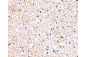 Immunohistochemical staining of human brain tissue using GRIK1 polyclonal antibody  at 2. (GRIK1 抗体  (C-Term))