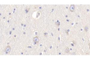 Detection of RETN in Bovine Cerebrum Tissue using Polyclonal Antibody to Resistin (RETN) (Resistin 抗体  (AA 19-109))