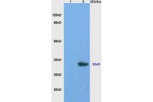 L1 mouse ovary lysates L2 mouse brain lysates probed with Anti StAR/StARD1 Polyclonal Antibody, Unconjugated (ABIN700960) at 1:200 overnight at 4 °C. (STAR 抗体  (AA 101-200))