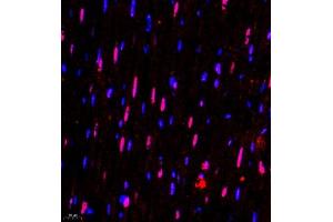 Immunofluorescence (Paraffin-embedded Sections) (IF (p)) image for anti-Survival Motor Neuron Domain Containing 1 (SMNDC1) antibody (ABIN7075773)