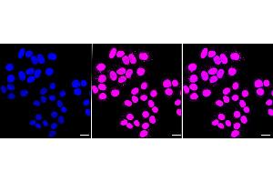 anti-Histone Deacetylase 8 (HDAC8) antibody