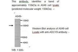 Image no. 1 for anti-Adenylate Cyclase 9 (ADCY9) antibody (ABIN790779)