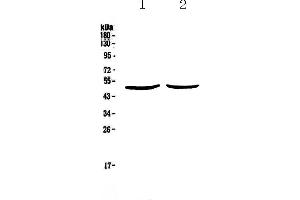 Western blot analysis of PLAU using anti-PLAU antibody . (PLAU 抗体  (AA 179-431))