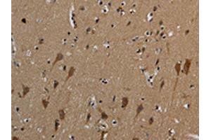 The image on the left is immunohistochemistry of paraffin-embedded Human brain tissue using ABIN7191019(HSPG2 Antibody) at dilution 1/50, on the right is treated with synthetic peptide. (HSPG2 抗体)