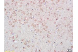Formalin-fixed and paraffin embedded rat brain tissue labeled with Anti- TPH (Ser19) Polyclonal Antibody, Unconjugated(ABIN2179763) 1:200 followed by conjugation to the secondary antibody and DAB staining (Tryptophan Hydroxylase 2 抗体  (pSer19))