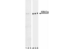 Western blot analysis of BLNK (pY84) in human Burkitt’s lymphoma. (B-Cell Linker 抗体  (pTyr84))