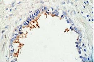 Human lung tissue was staned by Rabbit Anti-AdrenomeduIIiln (1-44) (Human) Antibody (Adrenomedullin 抗体  (AA 1-44))