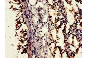 Immunohistochemistry of paraffin-embedded human lung tissue using ABIN7148376 at dilution of 1:100 (CD55 抗体  (AA 35-126))
