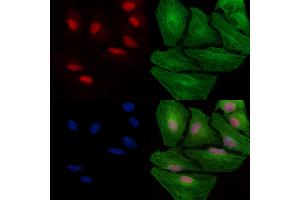 Phospho-MSH2 (Tyr238) Antibody staining A549 cells(heat shock treatment) by IF/ICC.