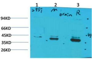 Western Blot (WB) analysis of 1)293T, 2)Mouse Brain Tissue, 3) Rat Brain Tissue with CABP2 Rabbit Polyclonal Antibody diluted at 1:2000. (CABP2 抗体)