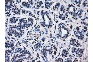 Immunohistochemical staining of paraffin-embedded breast tissue using anti-RPA2 mouse monoclonal antibody. (RPA2 抗体)