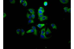 Immunofluorescence staining of MCF-7 cells with ABIN7143399 at 1:133, counter-stained with DAPI. (Adhesion G Protein-Coupled Receptor G1 (ADGRG1) (AA 26-216) 抗体)