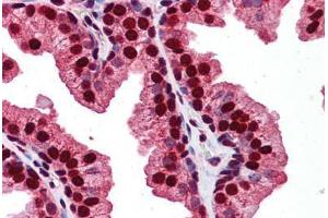 Human Prostate: Formalin-Fixed, Paraffin-Embedded (FFPE) (RAB23 抗体  (C-Term))