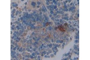 Used in DAB staining on fromalin fixed paraffin- embedded spleen tissue (Coronin 1a 抗体  (AA 1-204))