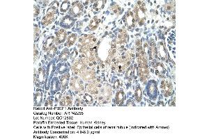 Rabbit Anti-PBEF1 Antibody  Paraffin Embedded Tissue: Human Kidney Cellular Data: Epithelial cells of renal tubule Antibody Concentration: 4. (NAMPT 抗体  (C-Term))