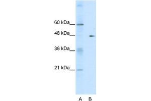 WB Suggested Anti-GDI2 Antibody Titration:  0. (GDI2 抗体  (C-Term))