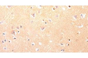 Immunohistochemistry of paraffin-embedded Human brain using CAPNS1 Polyclonal Antibody at dilution of 1:60 (Calpain S1 抗体)