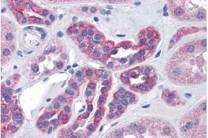 Immunohistochemistry (IHC) image for anti-ArfGAP with GTPase Domain, Ankyrin Repeat and PH Domain 2 (AGAP2) (Internal Region) antibody (ABIN570975)