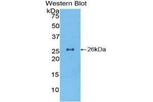 Detection of Recombinant TOR2A, Mouse using Polyclonal Antibody to Torsin 2A (TOR2A) (TOR2A 抗体  (AA 125-313))