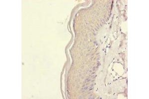 Immunohistochemistry of paraffin-embedded human skin tissue using ABIN7167451 at dilution of 1:100 (REEP5 抗体  (AA 120-189))