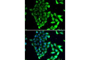 Immunofluorescence analysis of MCF-7 cells using MID1 antibody (ABIN6129304, ABIN6143835, ABIN6143836 and ABIN6223122). (MID1 抗体  (AA 478-667))