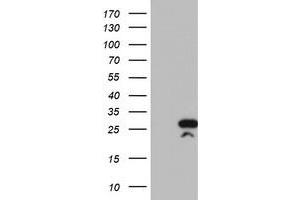 Western Blotting (WB) image for anti-Regulator of G-Protein Signaling 16 (RGS16) antibody (ABIN1500694) (RGS16 抗体)