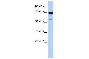 Western Blot showing ZNF587 antibody used at a concentration of 1-2 ug/ml to detect its target protein. (ZNF587 抗体  (Middle Region))