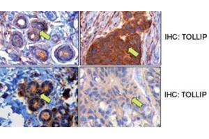 Immunohistochemistry (IHC) image for anti-Toll Interacting Protein (TOLLIP) antibody (ABIN3001486) (TOLLIP 抗体)