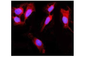 IF analysis of DDX58 using anti-DDX58 antibody (ABIN5518906).