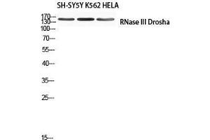 Western Blot (WB) analysis of SH-SY5Y K562 HeLa using RNase III Drosha antibody. (DROSHA 抗体)