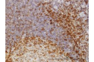 Immunoperoxidase of monoclonal antibody to SCAP1 on formalin-fixed paraffin-embedded human tonsil. (SKAP1 抗体  (AA 1-358))
