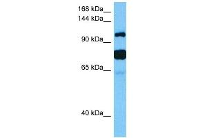 Host:  Mouse  Target Name:  HDAC4  Sample Tissue:  Mouse Testis  Antibody Dilution:  1ug/ml (HDAC4 抗体  (Middle Region))