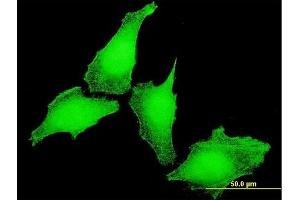 Immunofluorescence of monoclonal antibody to KCNIP4 on HeLa cell. (KCNIP4 抗体  (AA 1-250))