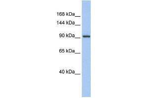 Human Muscle; WB Suggested Anti-ZNF295 Antibody Titration: 0. (ZNF295 抗体  (N-Term))