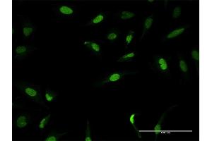 Immunofluorescence of purified MaxPab antibody to ZNF582 on HeLa cell. (ZNF582 抗体  (AA 1-517))
