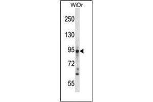 Western blot analysis of Desmoglein-3 Antibody (N-term) in WiDr cell line lysates (35ug/lane). (Desmoglein 3 抗体  (N-Term))