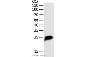 Western blot analysis of Human liver cancer tissue, using CRP Polyclonal Antibody at dilution of 1:1400 (CRP 抗体)