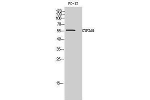 Western Blotting (WB) image for anti-Cytochrome P450, Family 2, Subfamily A, Polypeptide 6 (CYP2A6) (N-Term) antibody (ABIN3174643) (CYP2A6 抗体  (N-Term))