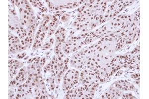 IHC-P Image Immunohistochemical analysis of paraffin-embedded Cal27 xenograft, using MST1, antibody at 1:500 dilution. (STK4 抗体  (C-Term))