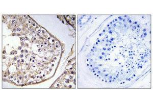 Immunohistochemistry (IHC) image for anti-B Melanoma Antigen Family, Member 3 (BAGE3) (Internal Region) antibody (ABIN1850876) (BAGE3 抗体  (Internal Region))