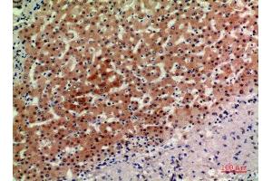 Immunohistochemistry (IHC) analysis of paraffin-embedded Human Liver, antibody was diluted at 1:200. (ACER2 抗体)
