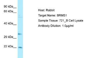 Host: RabbitTarget Name: BRMS1Antibody Dilution: 1. (BRMS1 抗体  (C-Term))