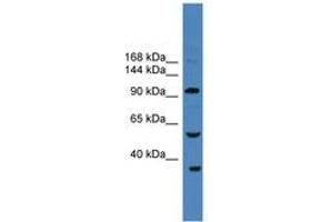Image no. 1 for anti-Ubiquitin Specific Peptidase 29 (USP29) (AA 181-230) antibody (ABIN6745286) (USP29 抗体  (AA 181-230))