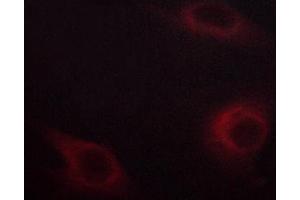 ABIN6267219 staining HeLa cells by ICC/IF.