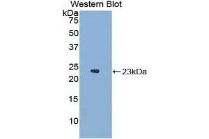 Western blot analysis of the recombinant protein. (NCF2 抗体  (AA 354-525))