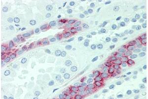 Anti-SLC4A2 antibody  ABIN1049341 IHC staining of human kidney. (SLC4A2 抗体  (Internal Region))