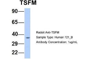 Host: Rabbit Target Name: TSFM Sample Type: Human 721_B Antibody Dilution: 1. (TSFM 抗体  (Middle Region))