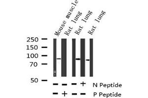 Western Blotting (WB) image for anti-CD44 (CD44) (pSer706) antibody (ABIN6256409)