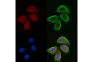 ABIN6256539 and ABIN6274072 staining Hela cells(45 min of heat-shock) by IF/ICC. (CDKN1C 抗体  (pThr310))